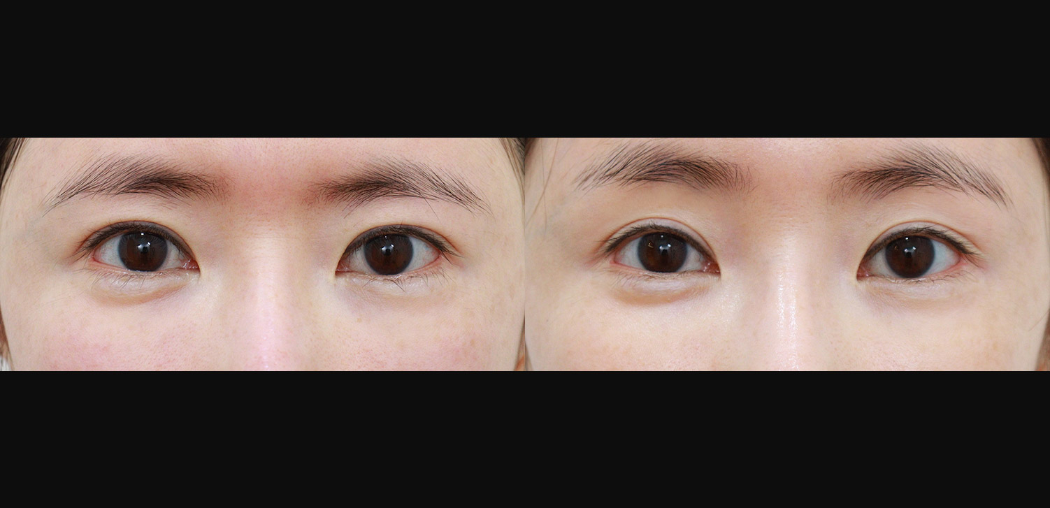 내시경 이마거상