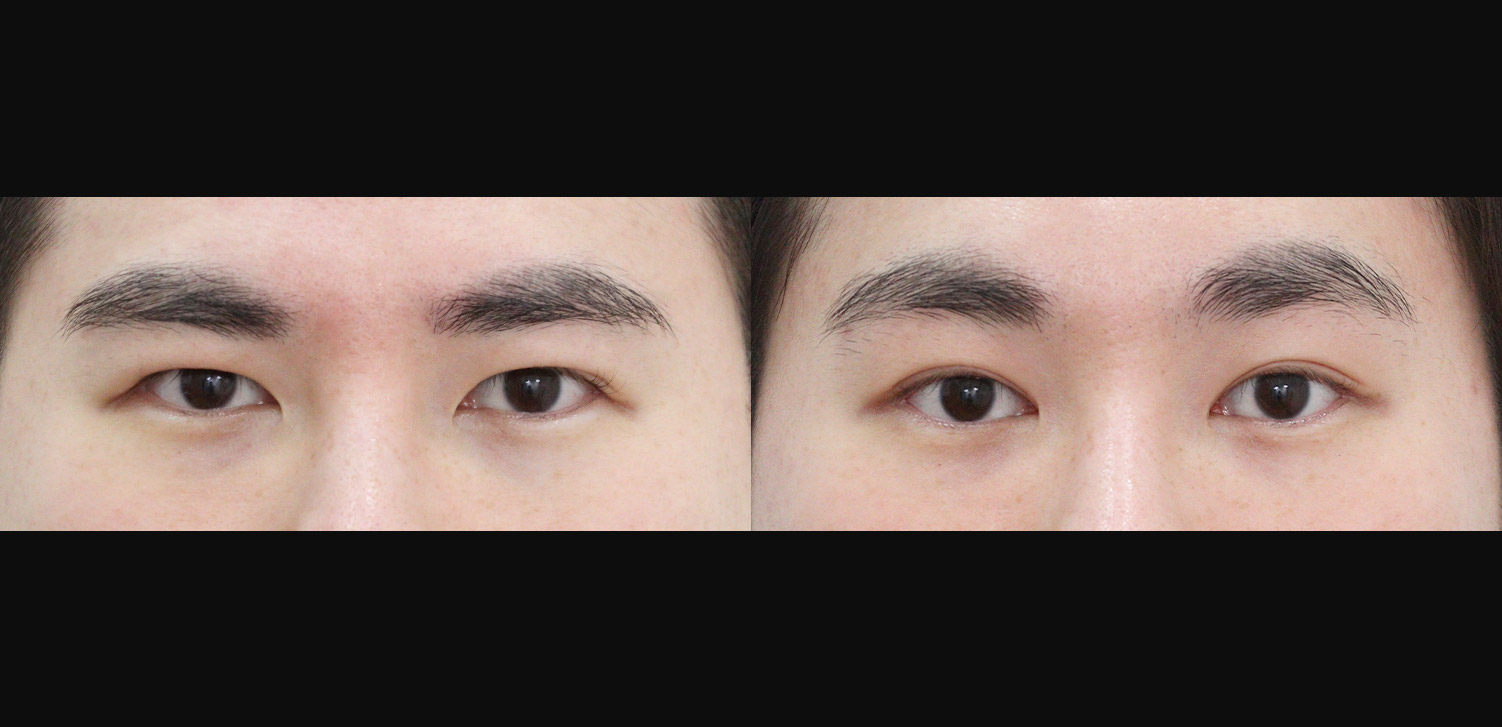 내시경 이마거상